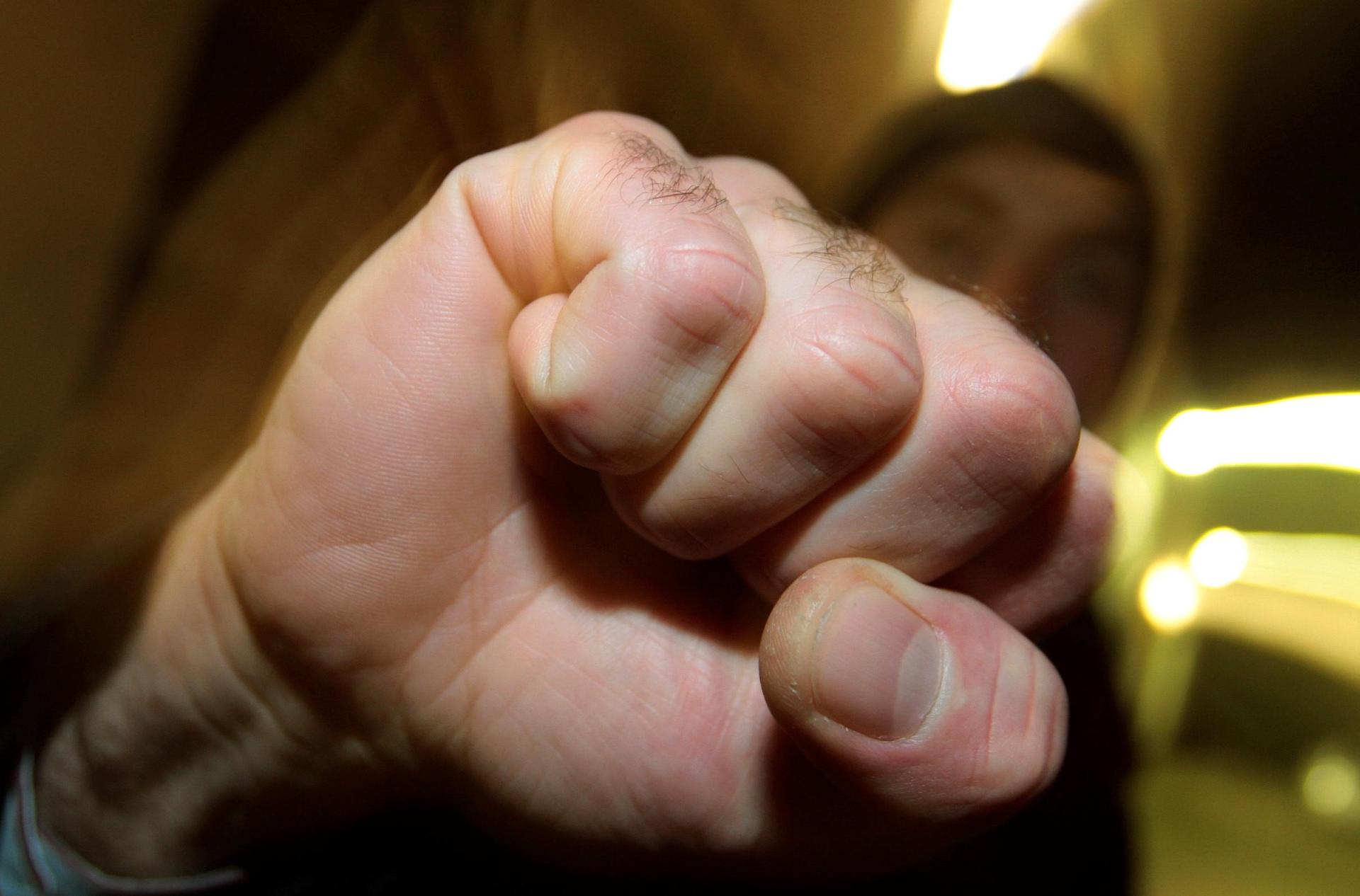 Weil sich ein Anwohner über einen Klingelstreich geärgert hatte, setzte es Ohrfeigen.  (Bild: Karl-Josef Hildenbrand/dpa)