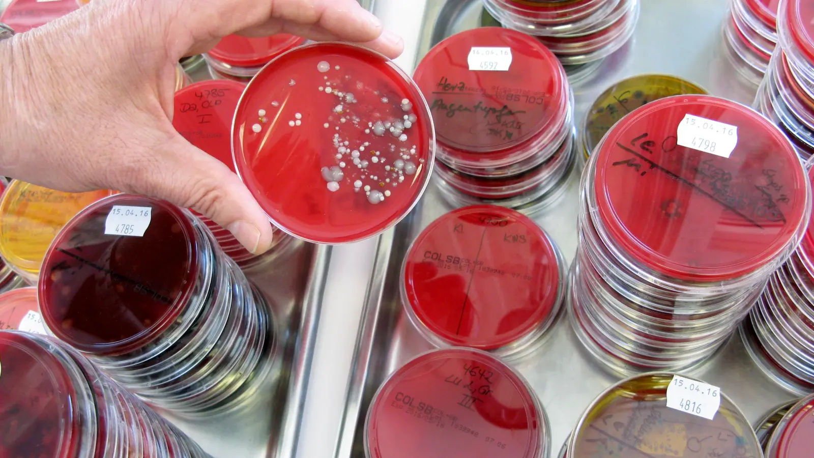 Das Landesamt für Gesundheit und Lebensmittelsicherheit hat im Zusammenhang mit einem Todesfall im Landkreis Schwandorf Proben untersucht. Nun liegen erste Ergebnisse vor.  (Symbolbild: Carolin Eckenfels/dpa)